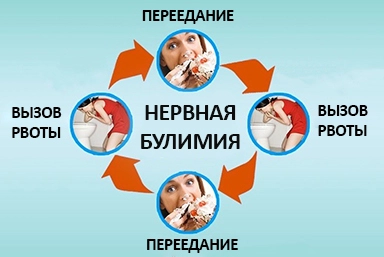 Лечение булимии в Агинском